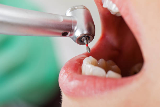 Best Tooth Pain Emergency Relief  in Decordova, TX